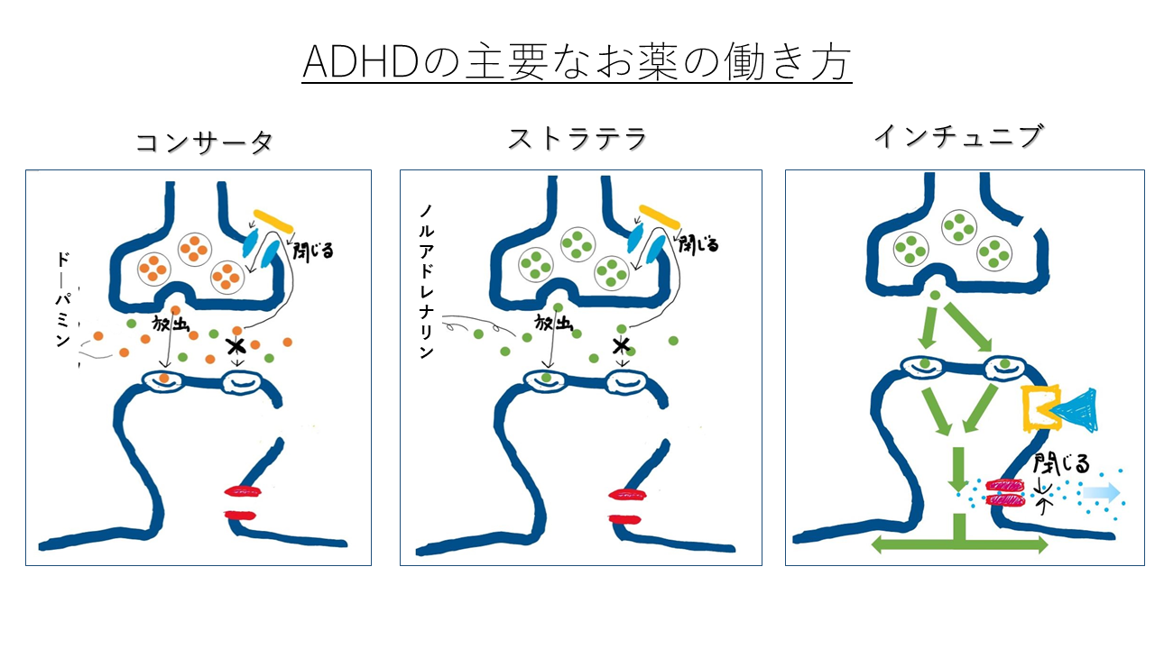 Adhdのお薬は飲むべきでしょうか 株式会社kaien 発達障害の方のための就職応援企業